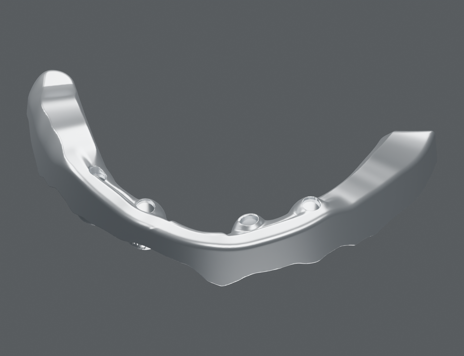 Diseño digital de una barra de titanio sobre implantes